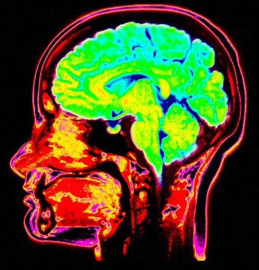 (图)大脑扫描器可阅读人类梦境 看到动态梦境内容