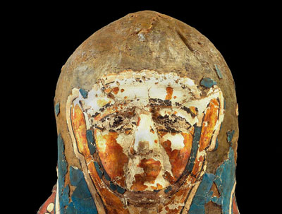 一具具有两千多年的埃及木乃伊M1身上发现了小球形的肿瘤-第一例古埃及恶性前列腺癌