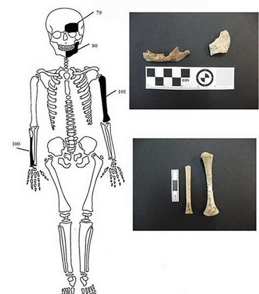 在坟墓中还发现少量烧焦的骨骼，考古学家推测这是坟墓中第5个人的尸骨，由于经过火化，无法揭晓其性别和身份，目前需要进一步测试。下一步将重点分析一具女性和两具男性尸