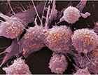 英国科学家发现抗癌新免疫疗法，