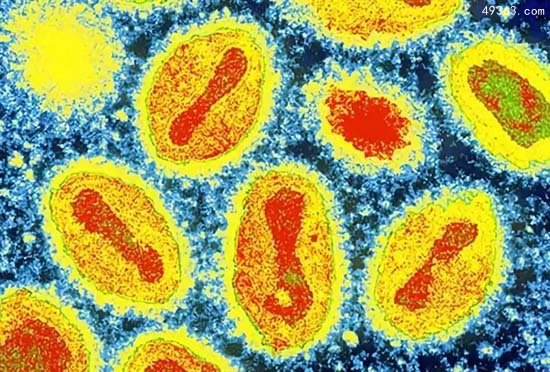 天花病毒:世界上影响最大的病毒 死了多少人?灭绝了吗?